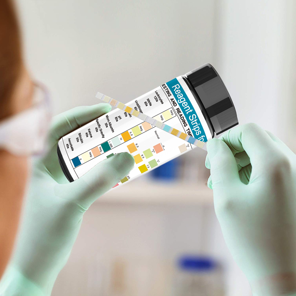100 Strips Urine Test Strip 10 - đánh giá và giá Urinalysis Reagent Strip